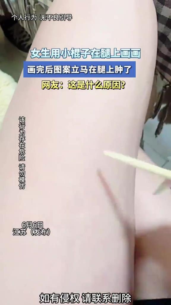 女生用小棍子在腿上画画 画完后图案立马在腿上肿了