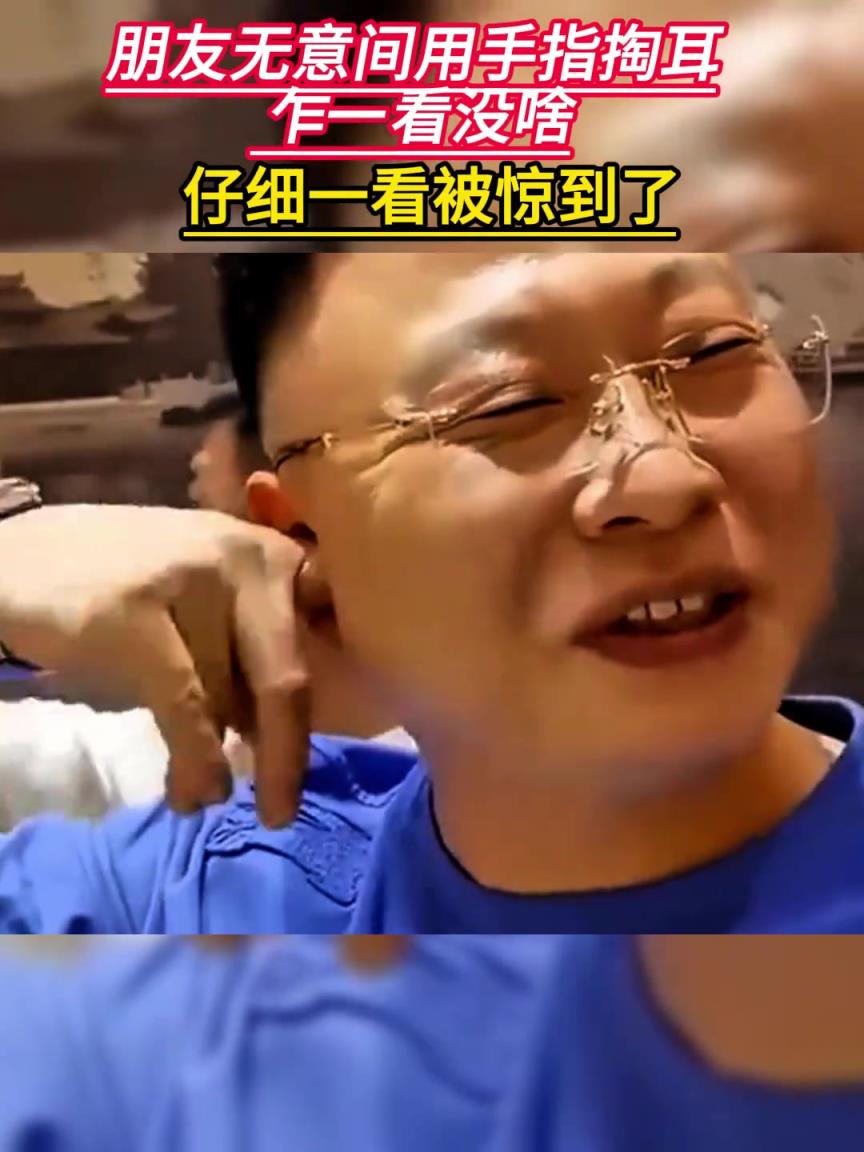 网友分享朋友无意间用手指掏耳朵,乍一看没啥 仔细一看被惊到了