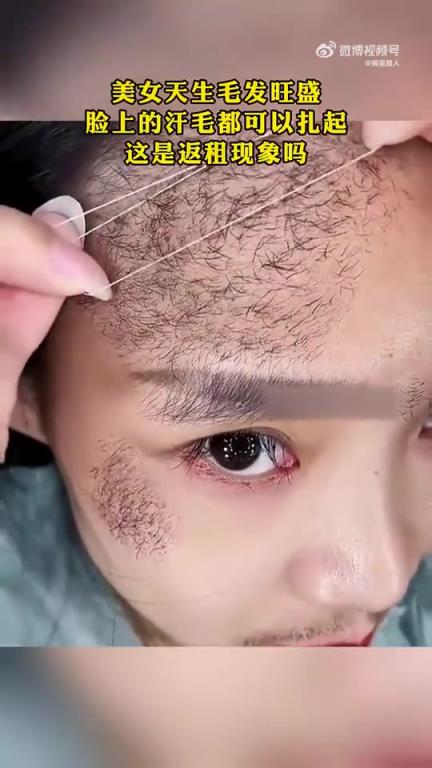 美女天生毛發(fā)旺盛，臉上汗毛竟可扎起