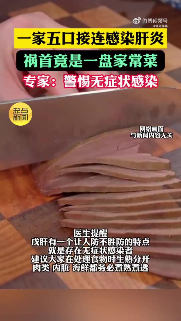 广州一家五口吃未熟猪肝染戊肝，医生：需高温煮透