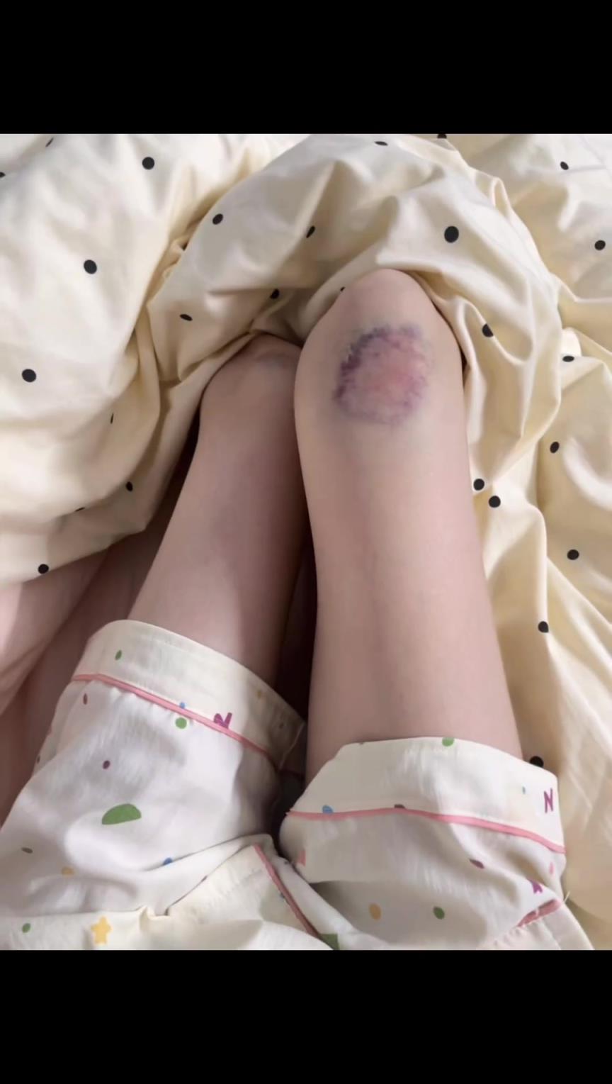 女生上班要迟到了？对自己下手那么狠啊！！
