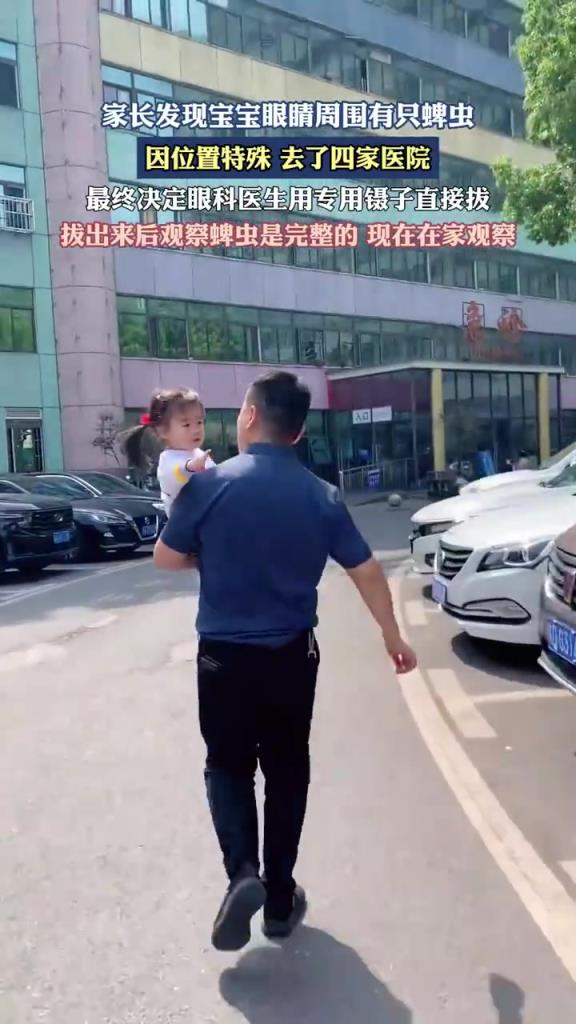 宝宝眼周卡蜱虫跑四家医院处理