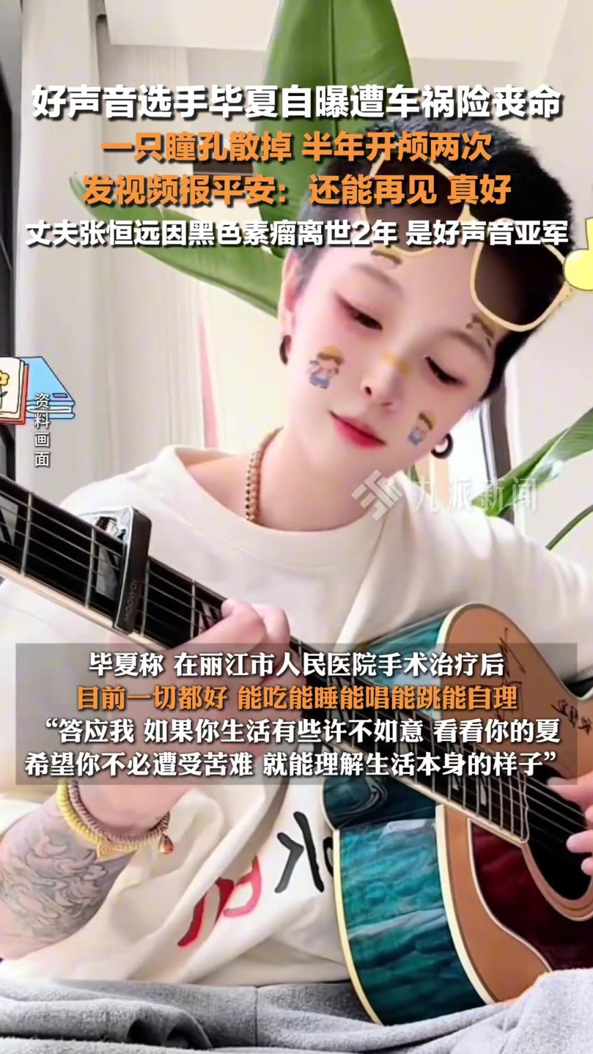 好聲音選手畢夏車禍半年開顱兩次