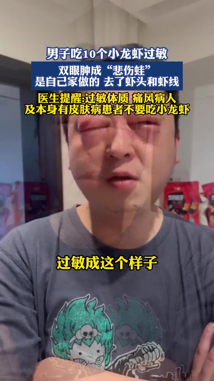 男子吃10个小龙虾过敏