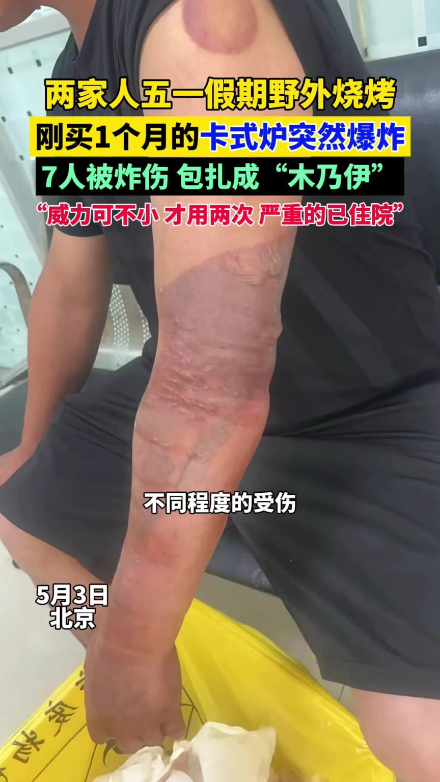 兩家人五一假期野外燒烤，剛買1個(gè)月的卡式爐突然爆炸