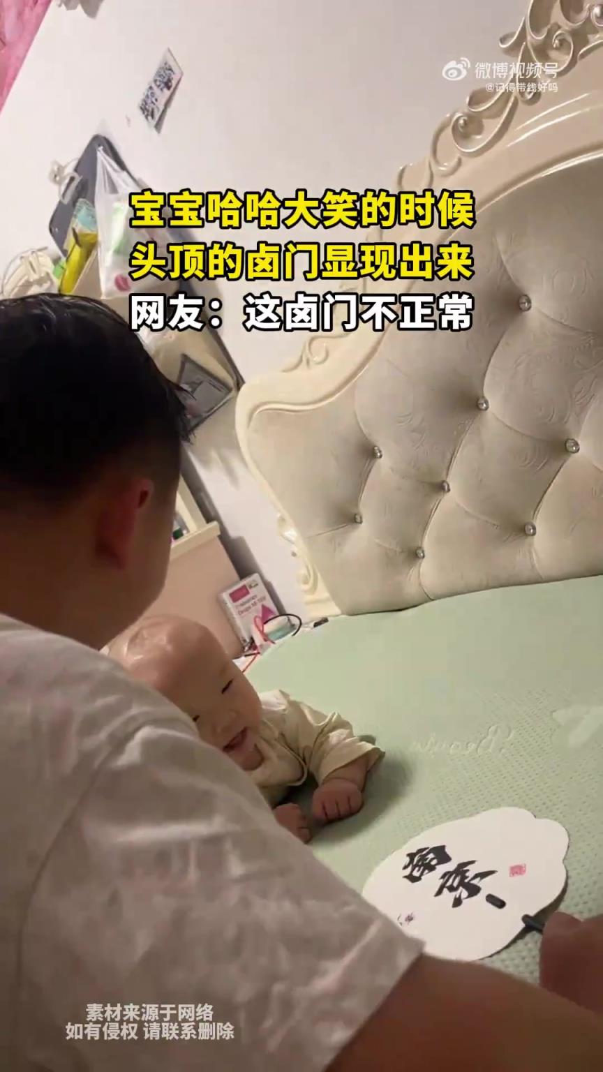 寶寶哈哈大笑的時候，頭頂?shù)柠u門顯現(xiàn)出來，網(wǎng)友：這鹵門不正常