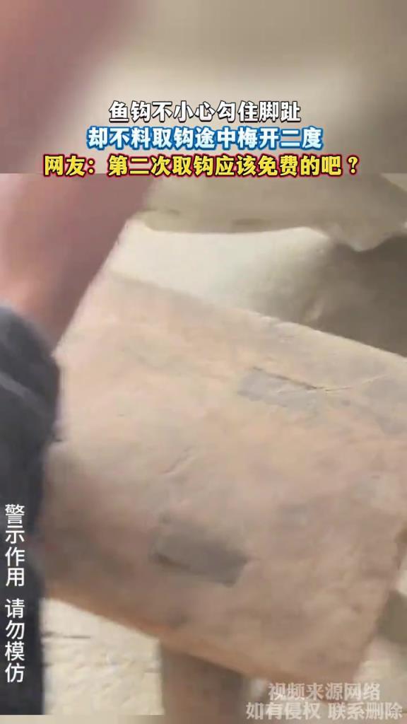 魚鉤不小心勾住腳趾 卻不料取鉤途中梅開二度