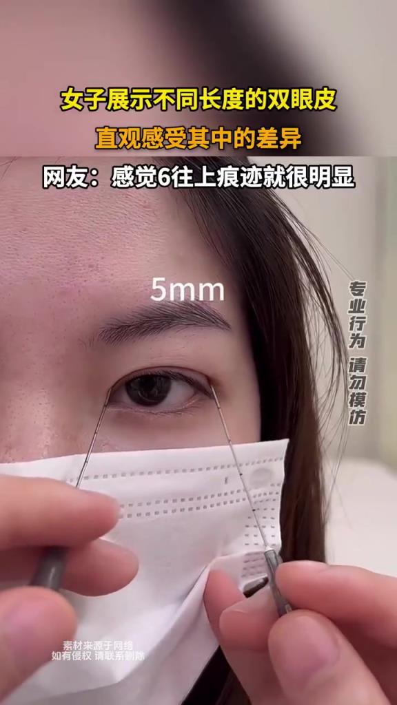 女子展示不同长度双眼皮，对比差异明显