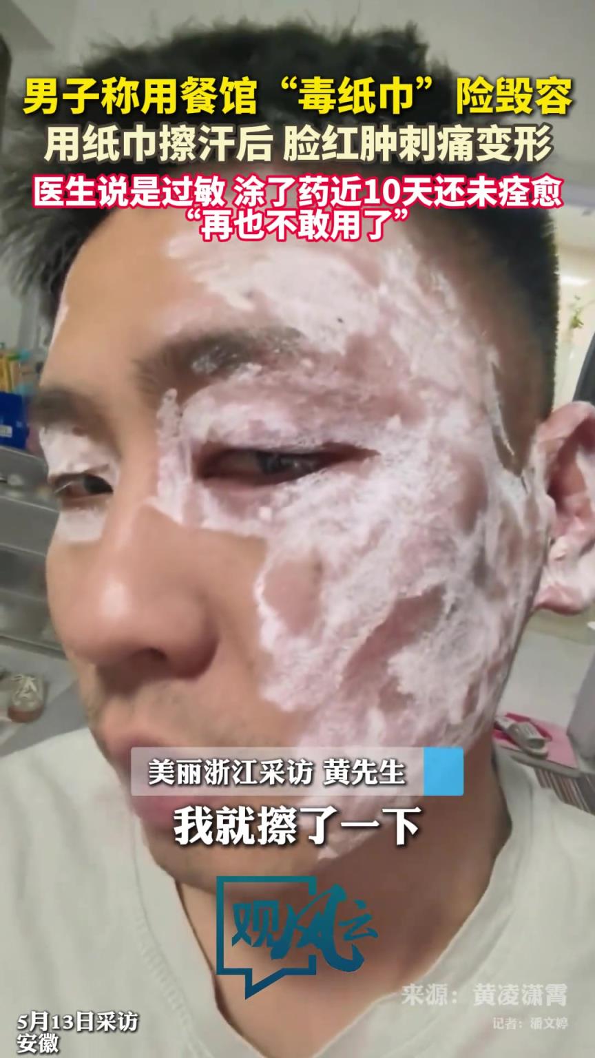 男子称用小餐馆毒纸巾险毁容 ！