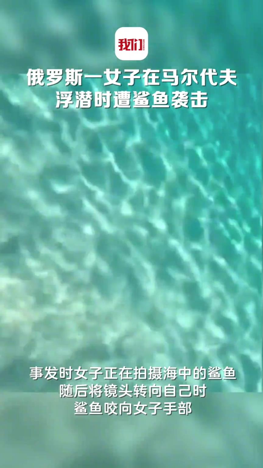 俄罗斯一女子在马尔代夫浮潜时遭鲨鱼袭击