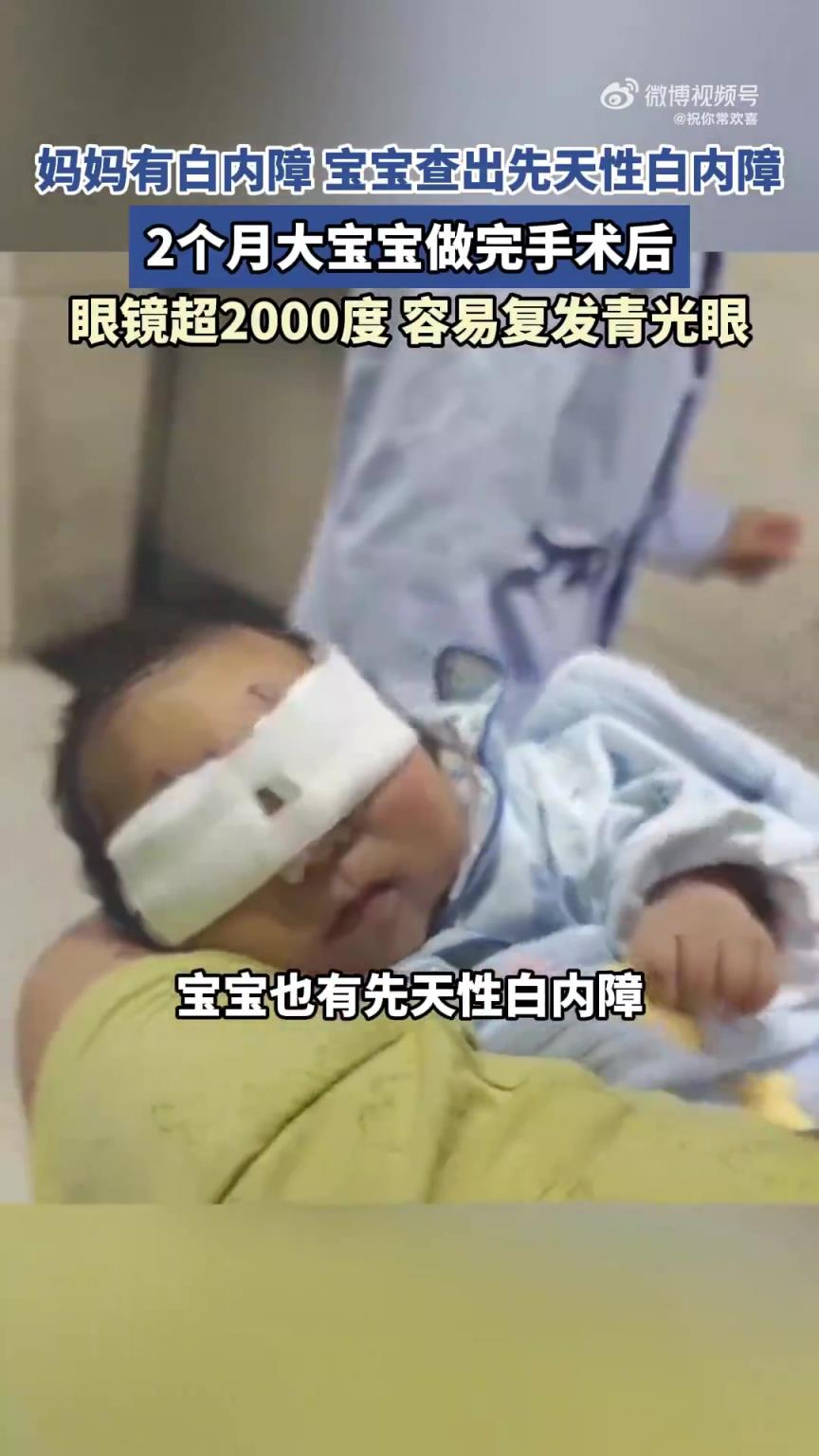 妈妈患白内障，2个月大宝宝查出先天性白内障且眼镜超2000度