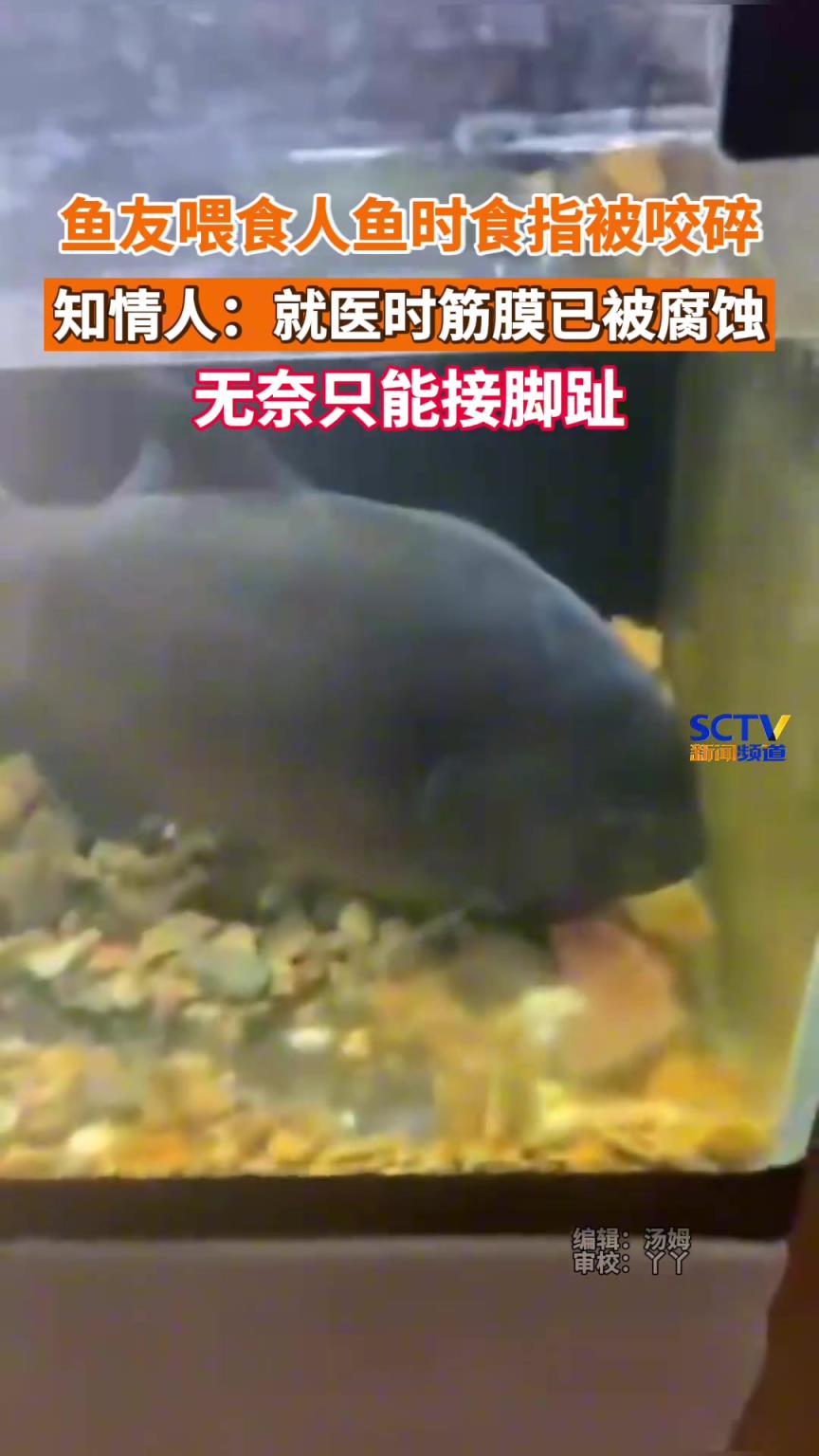 魚友喂食人魚時食指被咬碎，就醫(yī)時筋膜已被腐蝕