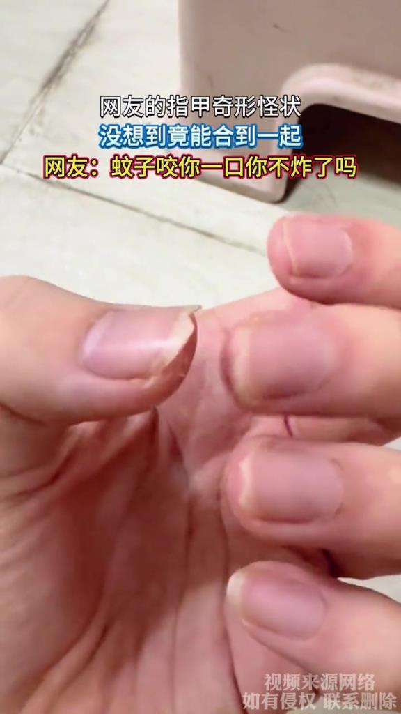 网友的指甲奇形怪状,没想到竟能合到一起!!!