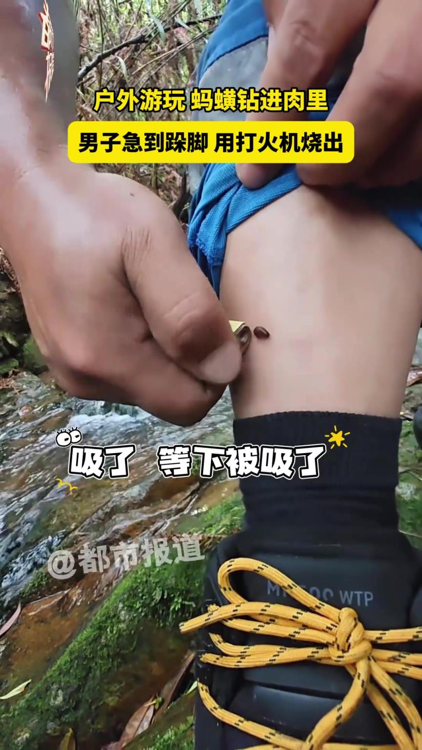 户外游玩，蚂蟥钻进肉里，男子急到跺脚用打火机烧出