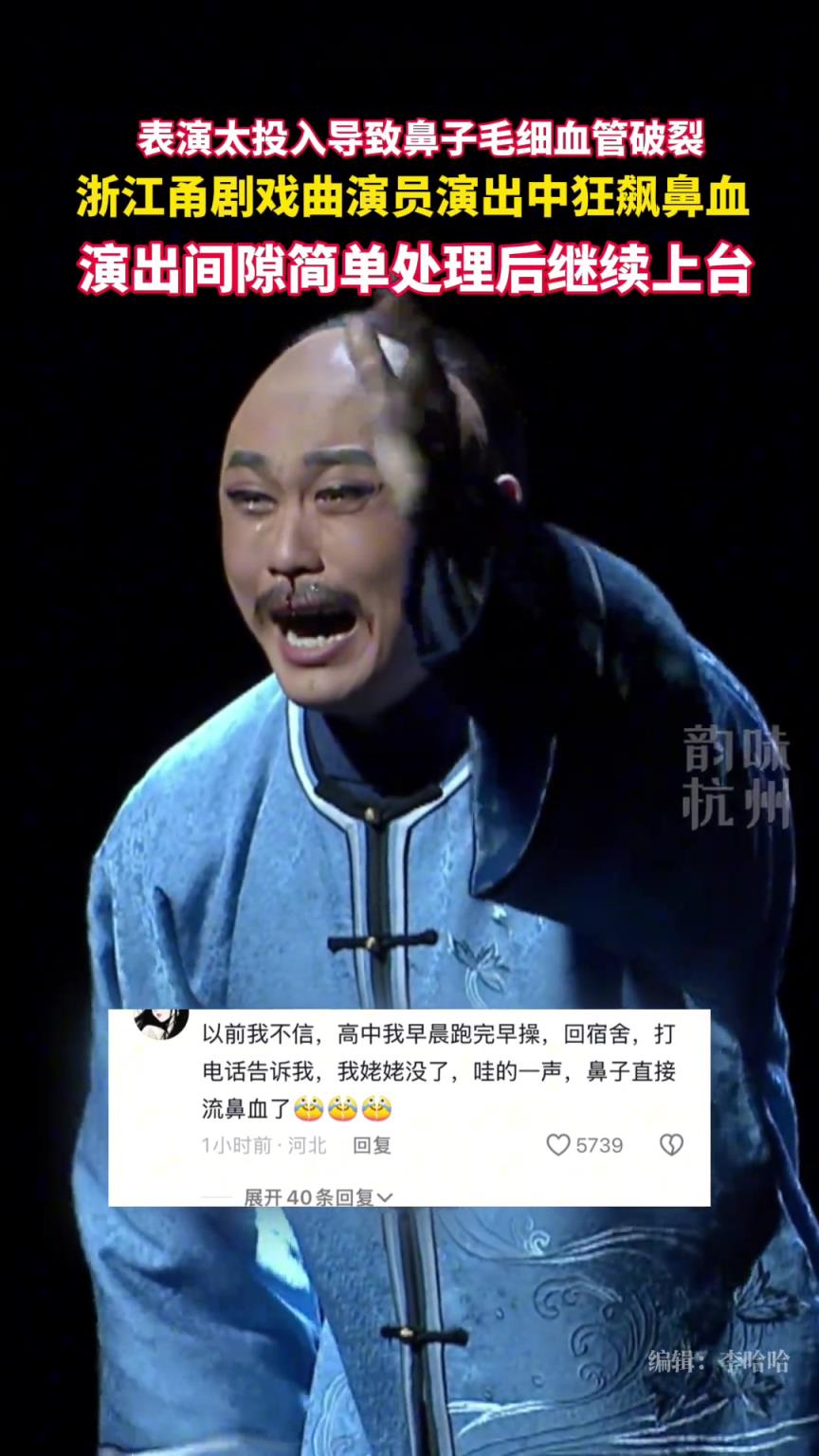 浙江甬剧演员表演时因情绪太投入，导致鼻子毛细血管破裂飙鼻血