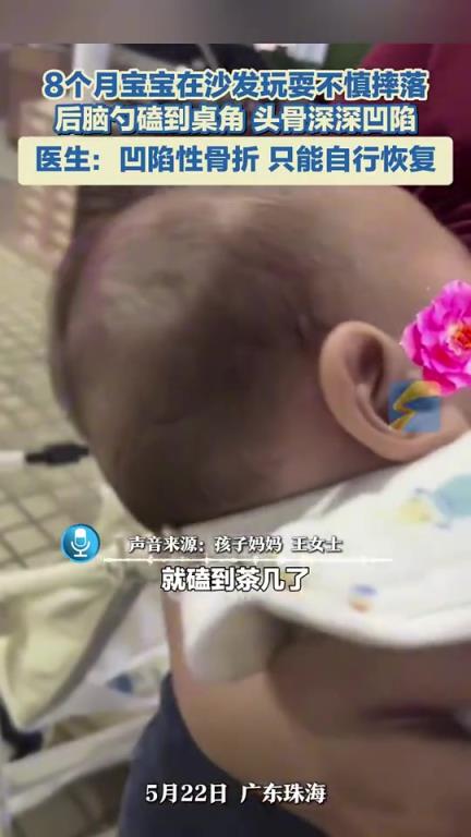 8个月宝宝不慎从沙发摔下，后脑勺磕到桌角，头骨深深凹陷