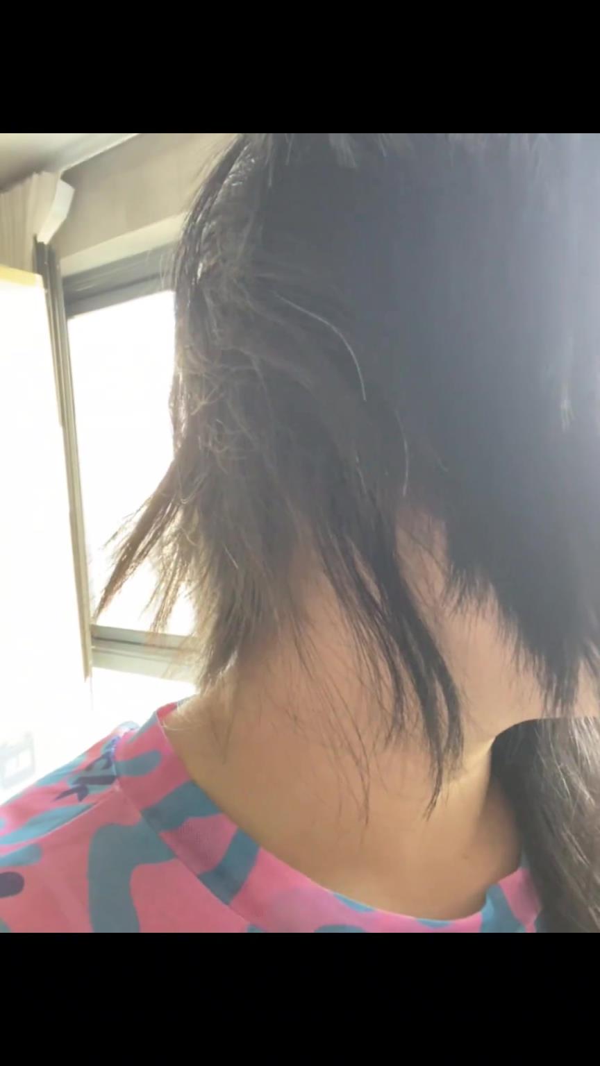 一觉起来头秃了！不愧是爸妈的小棉袄