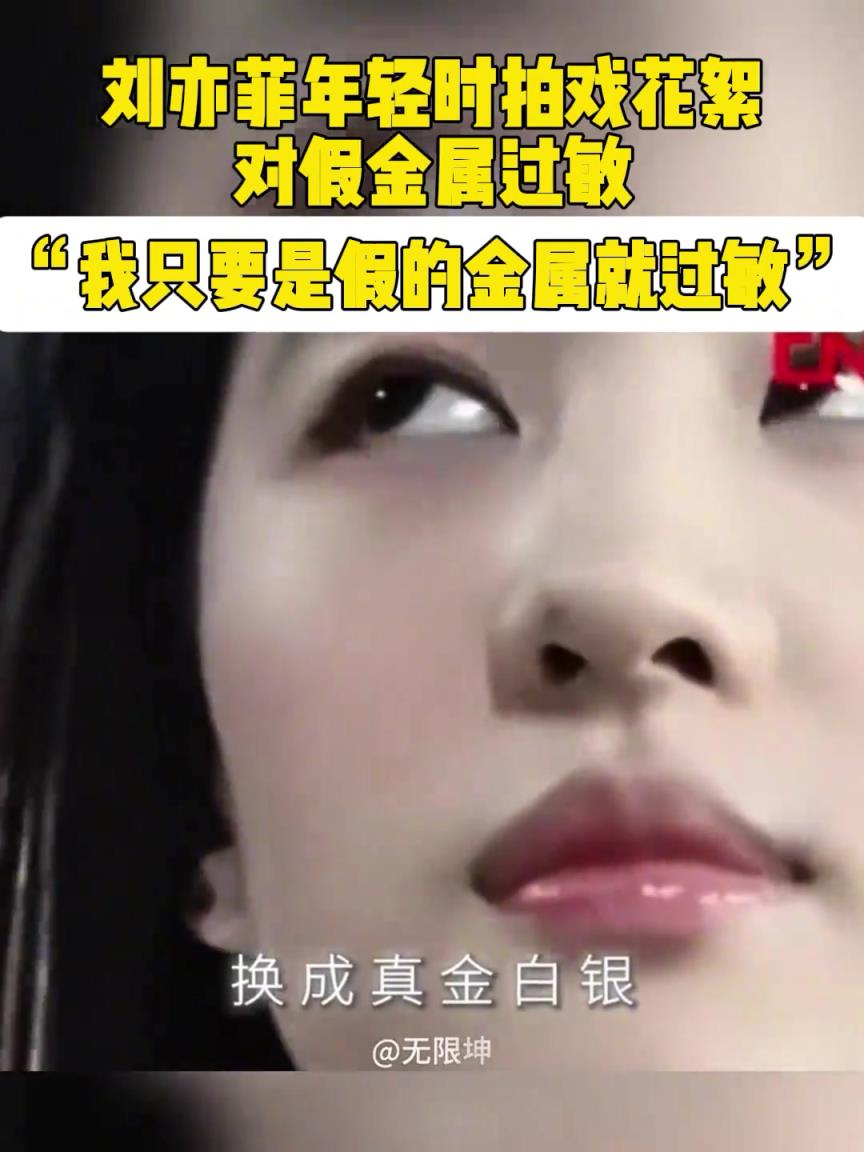 刘亦菲年轻时拍戏花絮对假金属过敏