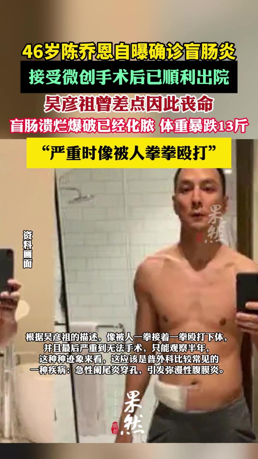 46歲陳喬恩自曝確診盲腸炎