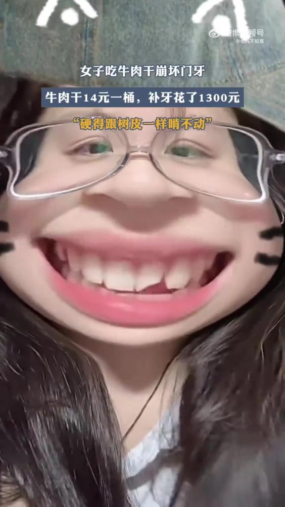 女子吃牛肉干崩壞門牙，牛肉干14元一桶，補牙花了1300元！