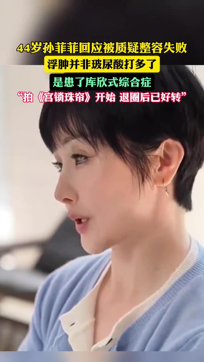 44歲孫菲菲回應(yīng)被質(zhì)疑“整容失敗”