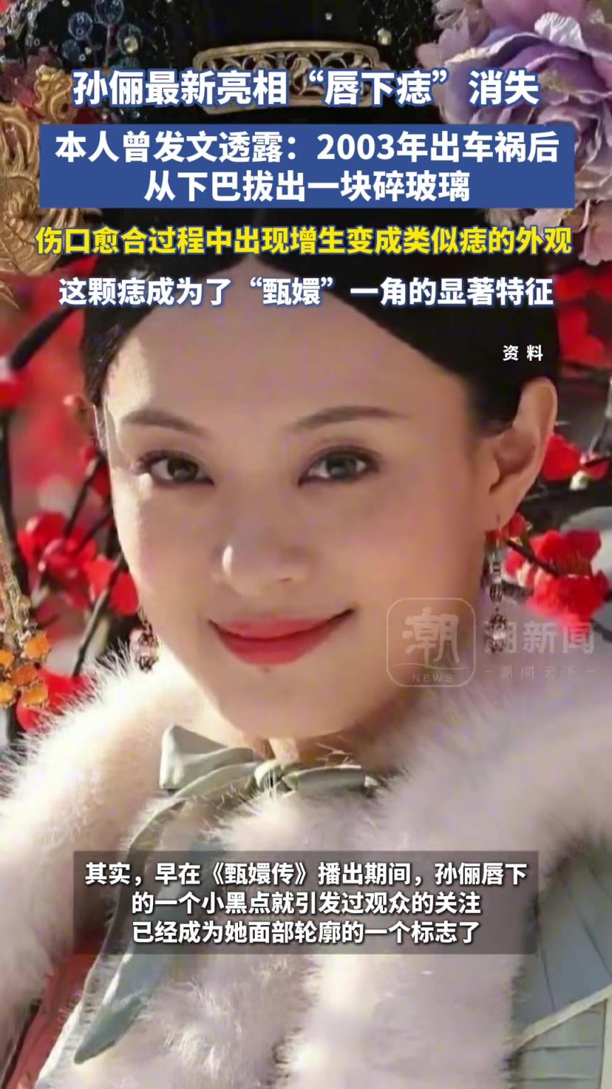 演員孫儷最新亮相唇下痣消失，引起熱烈討論
