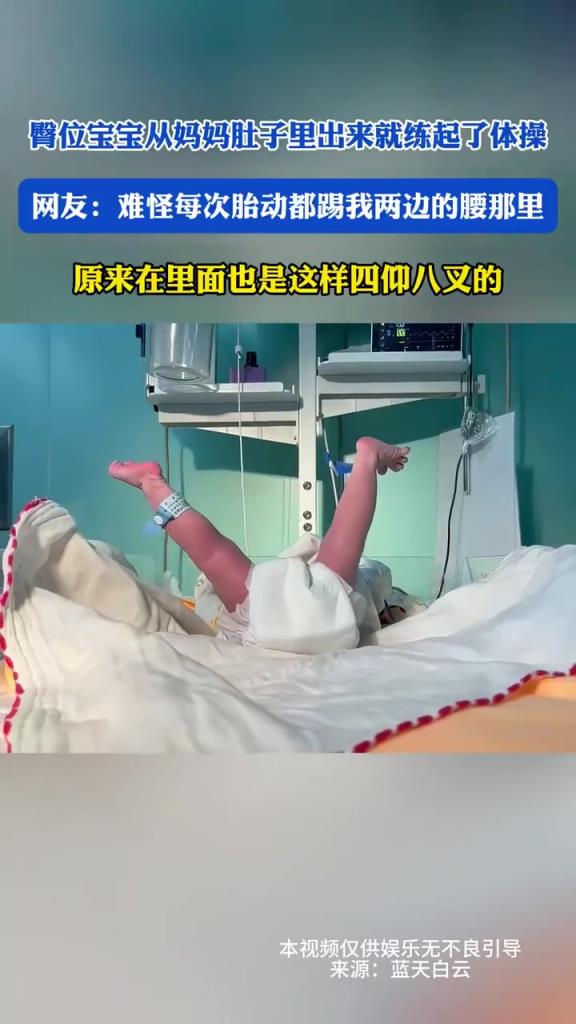 臀位宝宝从妈妈肚子里出来就练起了体操~