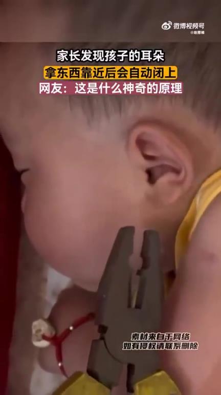 家長發(fā)現(xiàn)孩子耳朵：異物靠近時會自動閉合