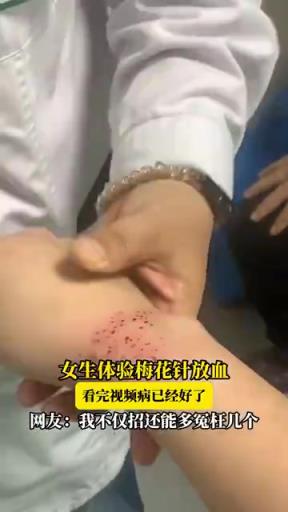 女生體驗(yàn)梅花針放血療法，網(wǎng)友：看著都覺得疼