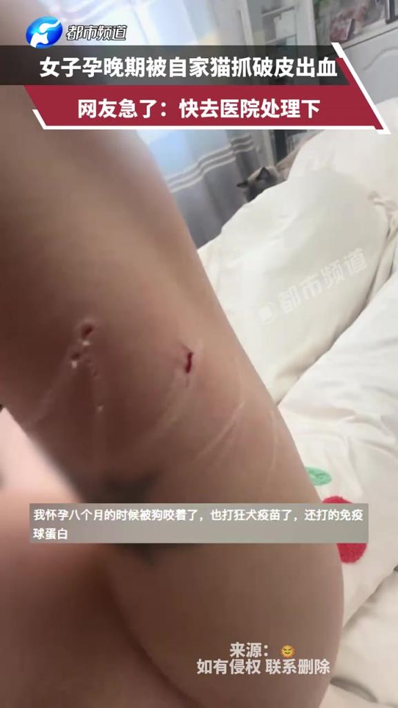 女子孕晚期被自家猫抓伤，网友急了：快去医院处理下