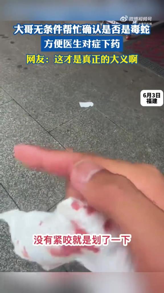 大哥无条件帮忙确认是否是毒蛇，方便医生对症下药