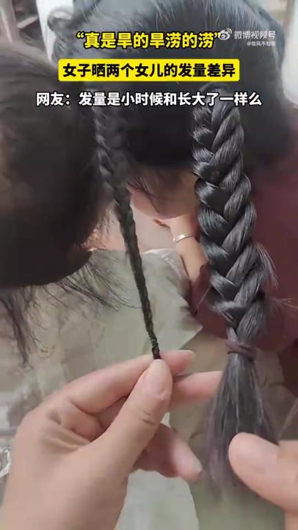 女子晒两女儿发量差异，网友调侃：小时候和长大发量一样？