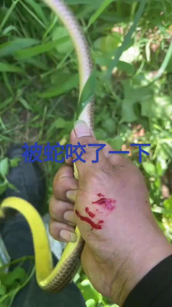 被蛇咬了还有心思拍视频吗？