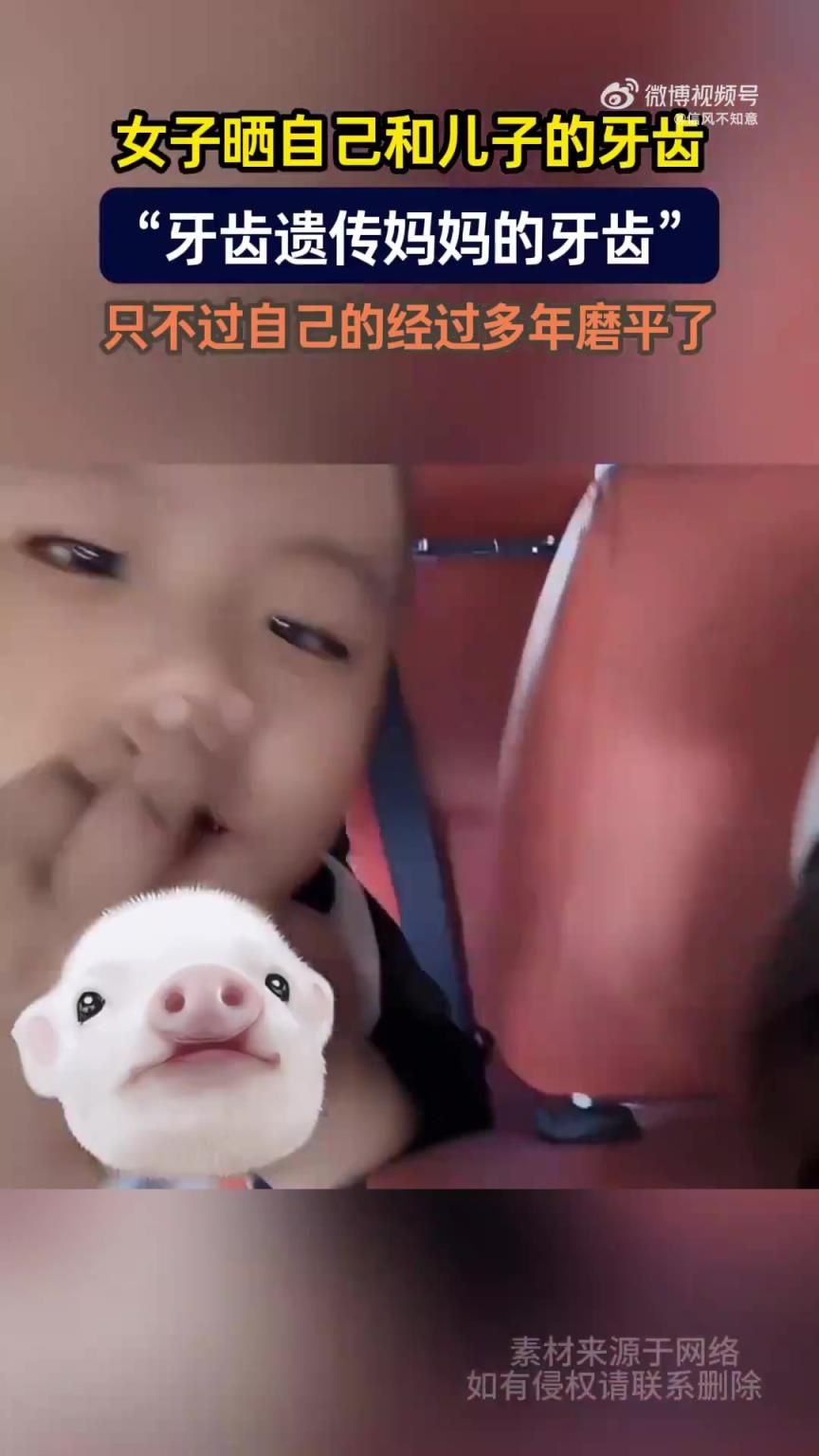女子曬與兒子牙齒，感嘆“牙齒遺傳媽媽”
