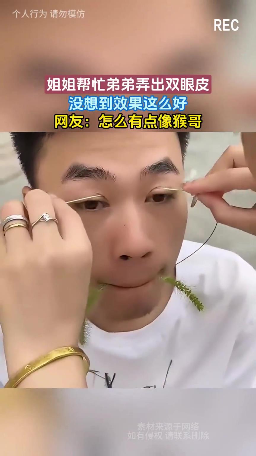 姐姐帮忙弟弟弄出双眼皮，没想到效果这么好