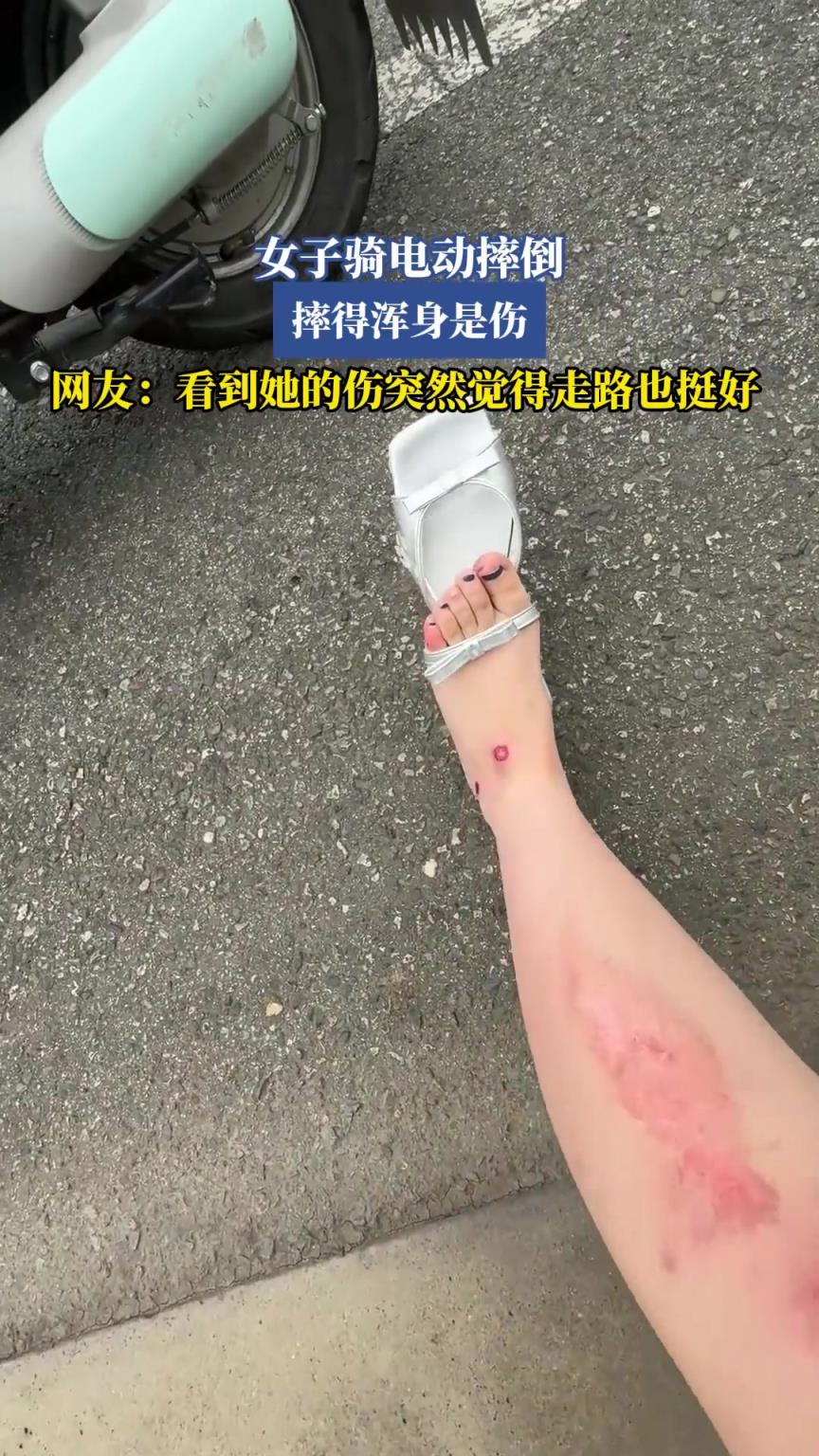 女子騎電動摔倒，摔得渾身是傷，看到她的傷突然覺得走路也挺好