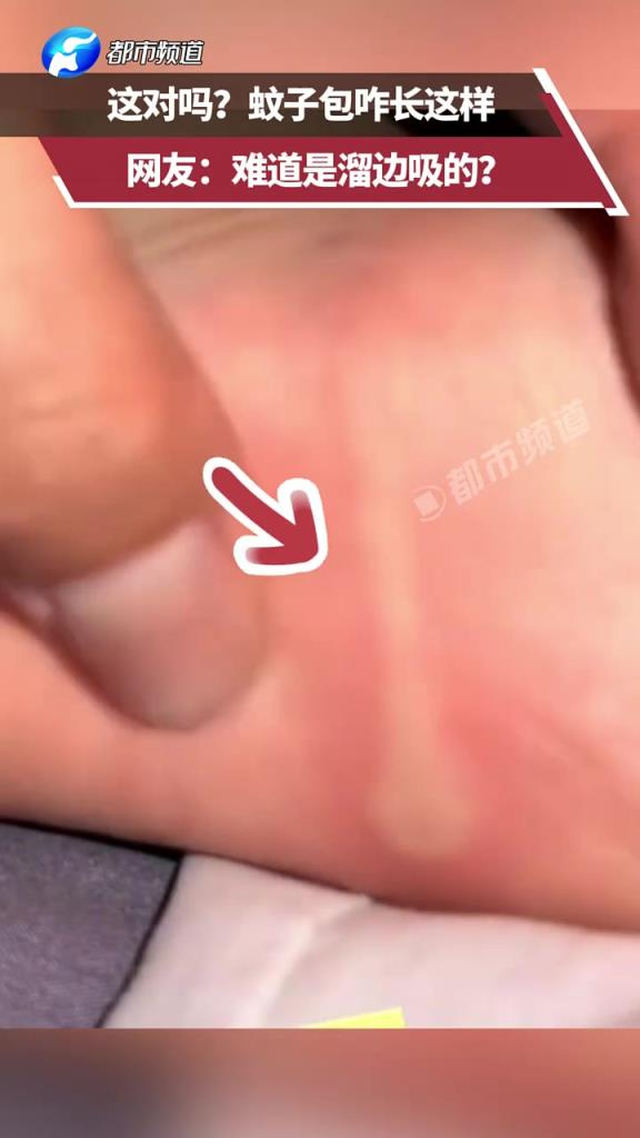 这对吗？蚊子包咋长这样？网友：难道是溜边吸的？