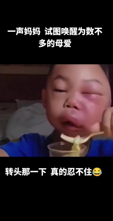 本來該是心疼的感覺，為啥總是忍不住想笑
