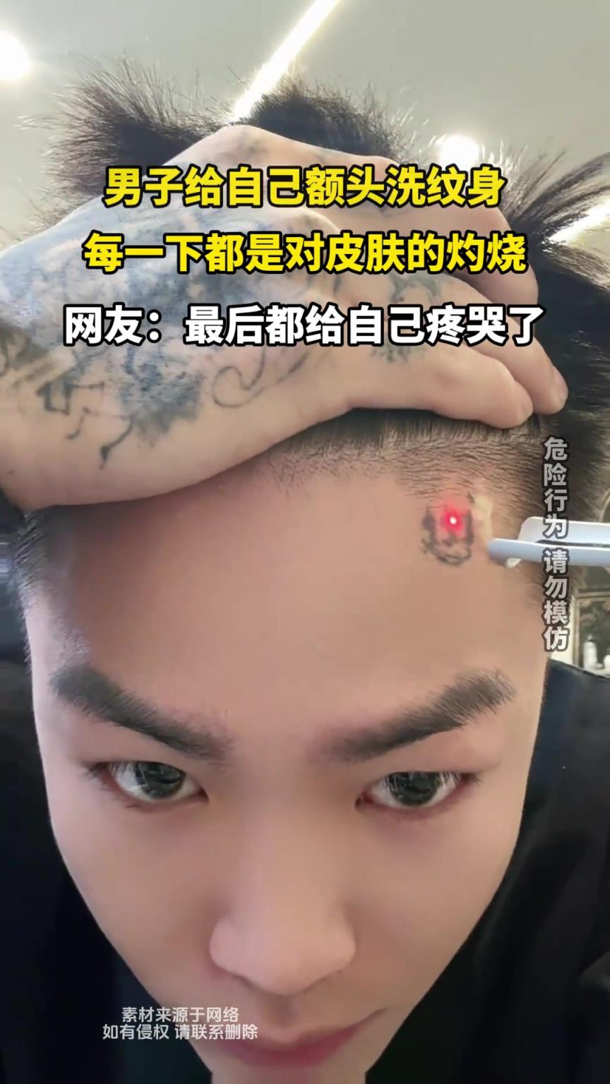男子給自己額頭洗紋身，每一下都是對(duì)皮膚的灼燒