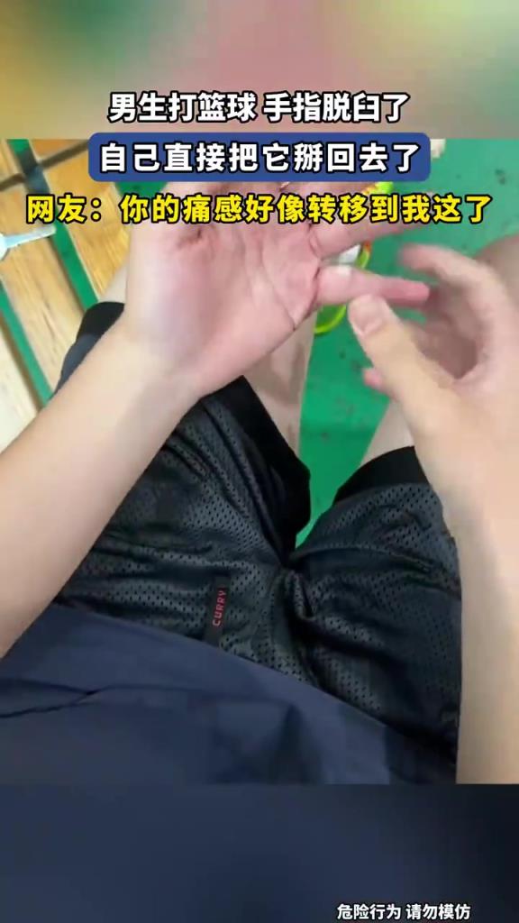 男生打篮球 手指脱臼了，自己直接把它掰回去了！