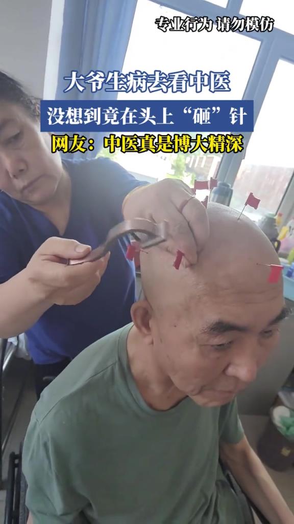 大爷生病去看中医,没想到竟在头上“砸”针!!!