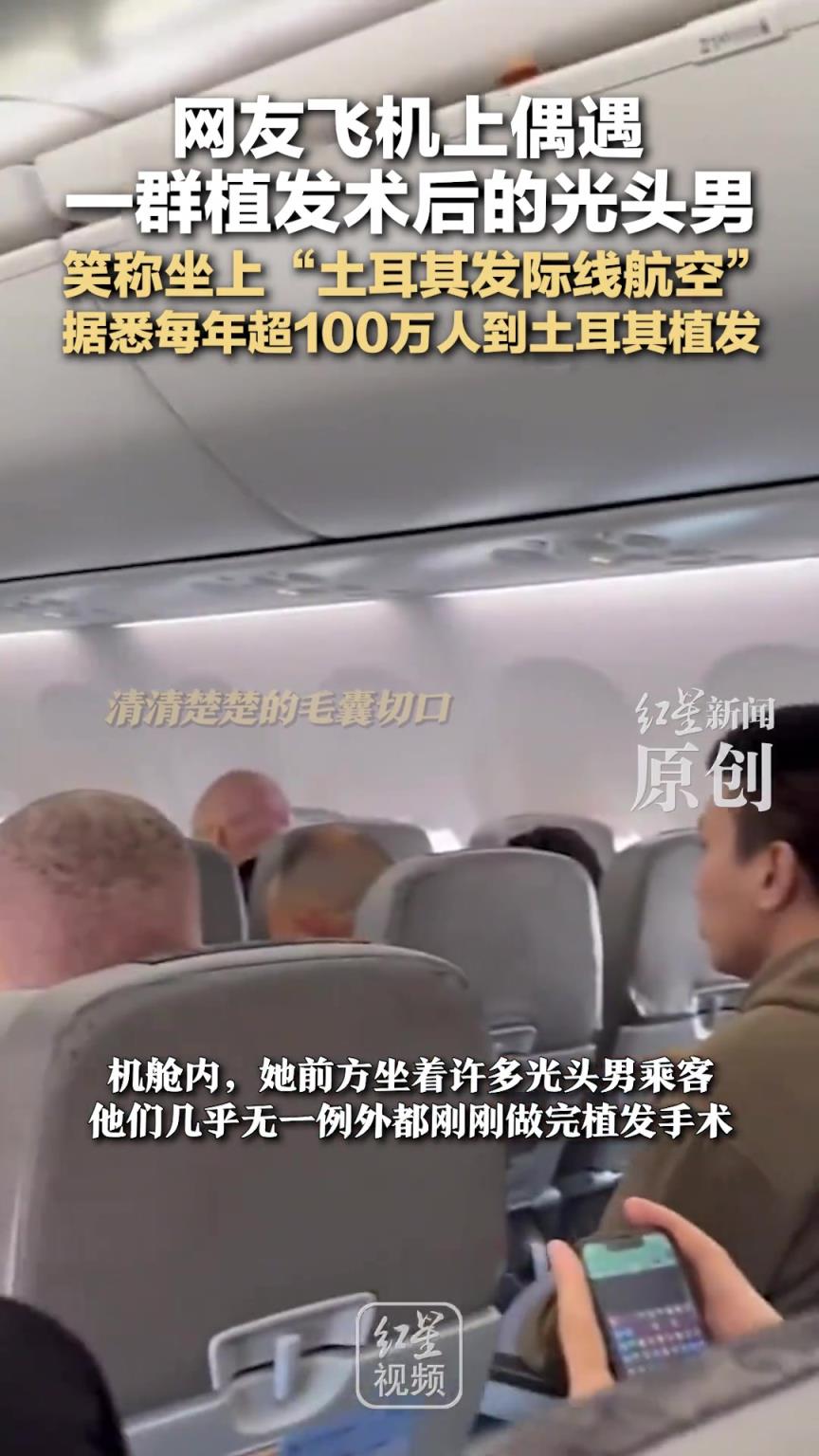 网友飞机上偶遇一群植发术后的光头男 笑称坐上土耳其发际线航