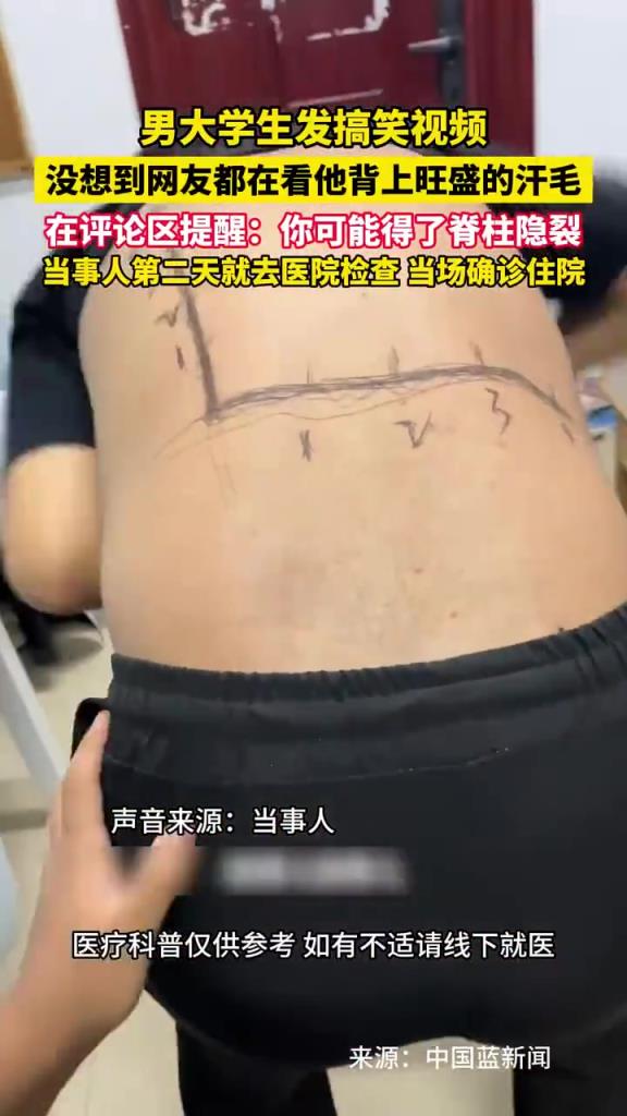 男大学生发搞笑视频，没想到网友都在看他背上旺盛的汗毛