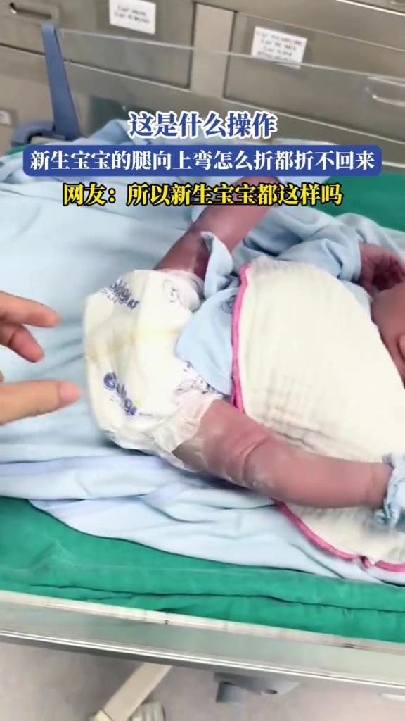 這是什么操作,新生寶寶的腿向上彎怎么折都折不回來!!