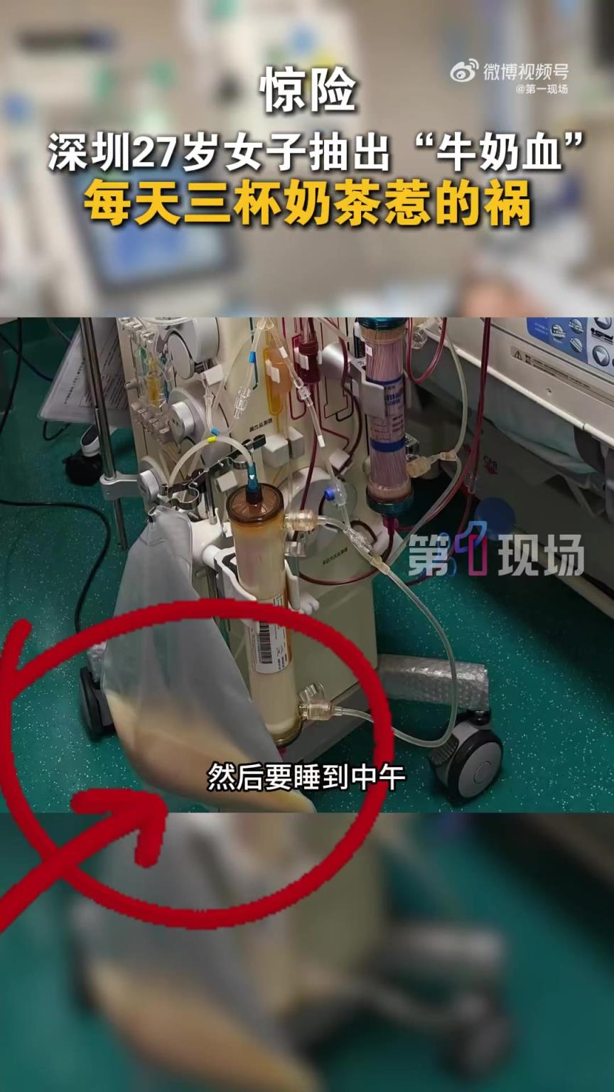 惊险！27岁女子1天3杯奶茶抽出牛奶血