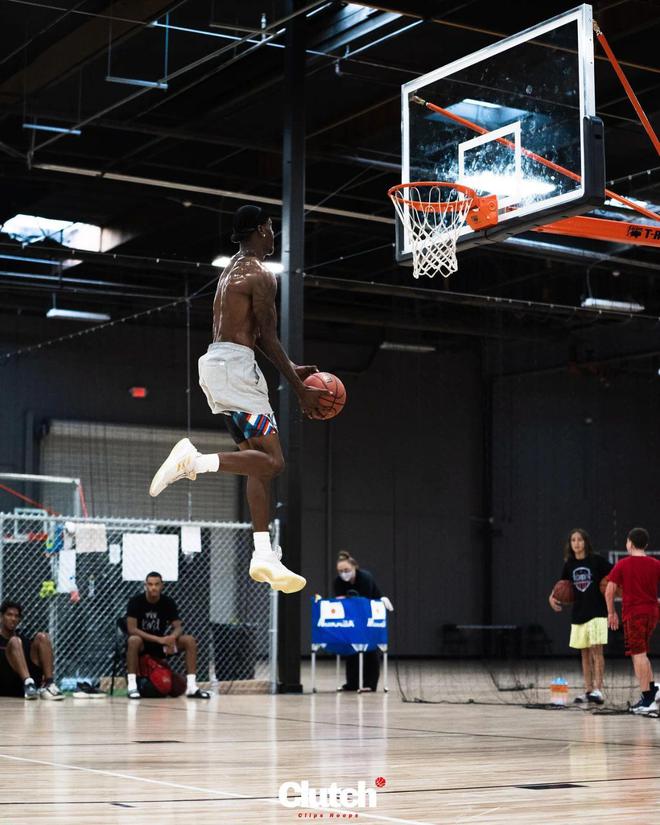 斷腿手術5次之后，他打進了NBA