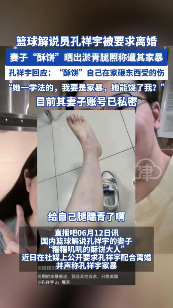 篮球解说员孔祥宇妻子“酥饼”晒出淤青腿照 称遭其家暴